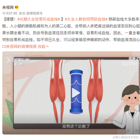 用户不头秃于2023-02-18 11:07发布的图片