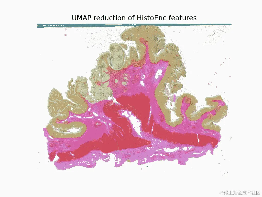 UMAP reduction of HistoEnc features