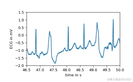 ../../_images/scipy-datasets-electrocardiogram-1_01_00.png