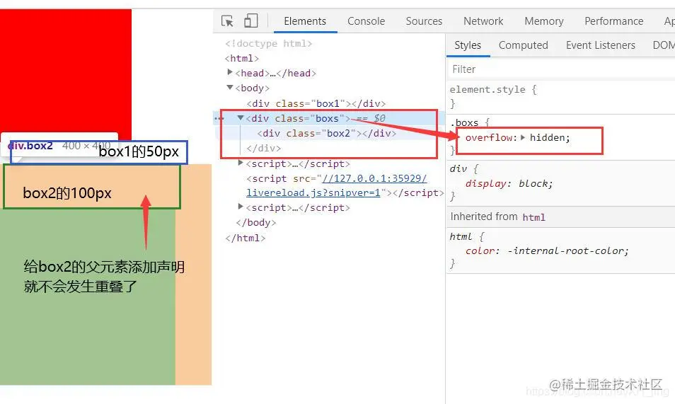 解决两个相邻的box的margin重叠