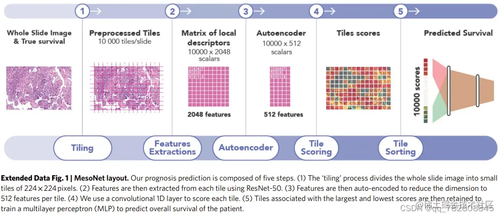 Deep learning-based classification of mesothelioma improves prediction of patient outcom