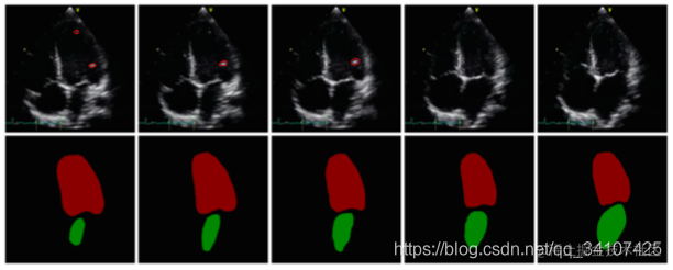 Medical image | DualGAN with pediatric echocardiography integral ...