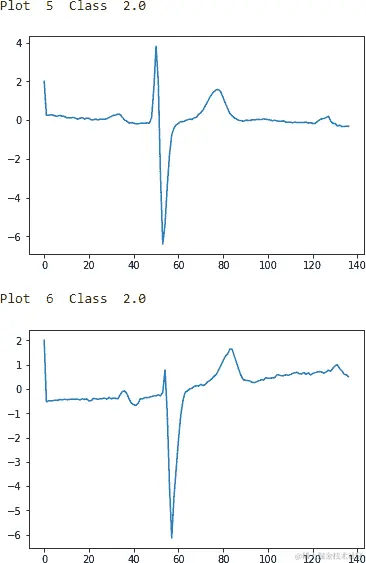 ECG Five Days Class 2.0 - Second Two Examples