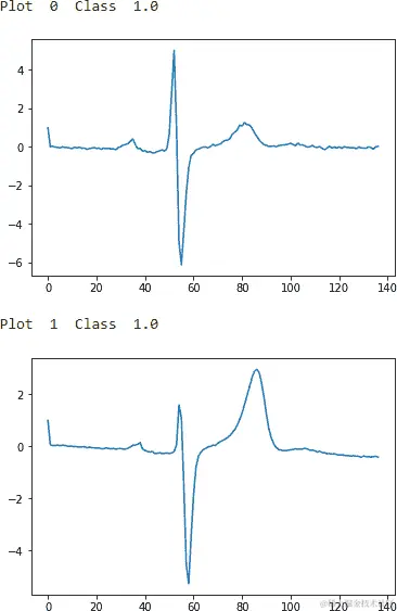 ECG Five Days Class 1.0 - First Two Examples