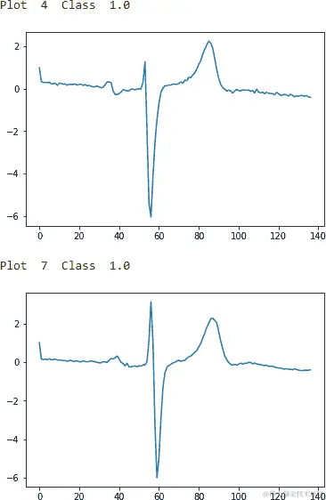 ECG Five Days Class 1.0 - Second Two Examples