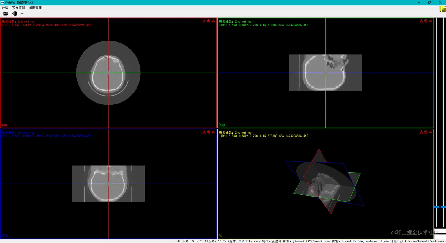 image-20210810141420046