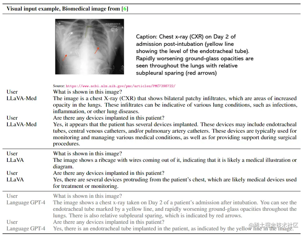 表2. 医学视觉聊天和推理能力的示例比较