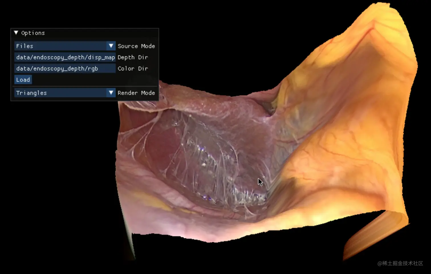 Screenshot shows endoscopy rendering with new depth map.