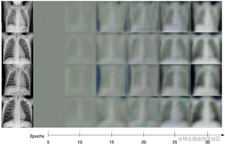Overview of generating synthetic covid images from the healthy category