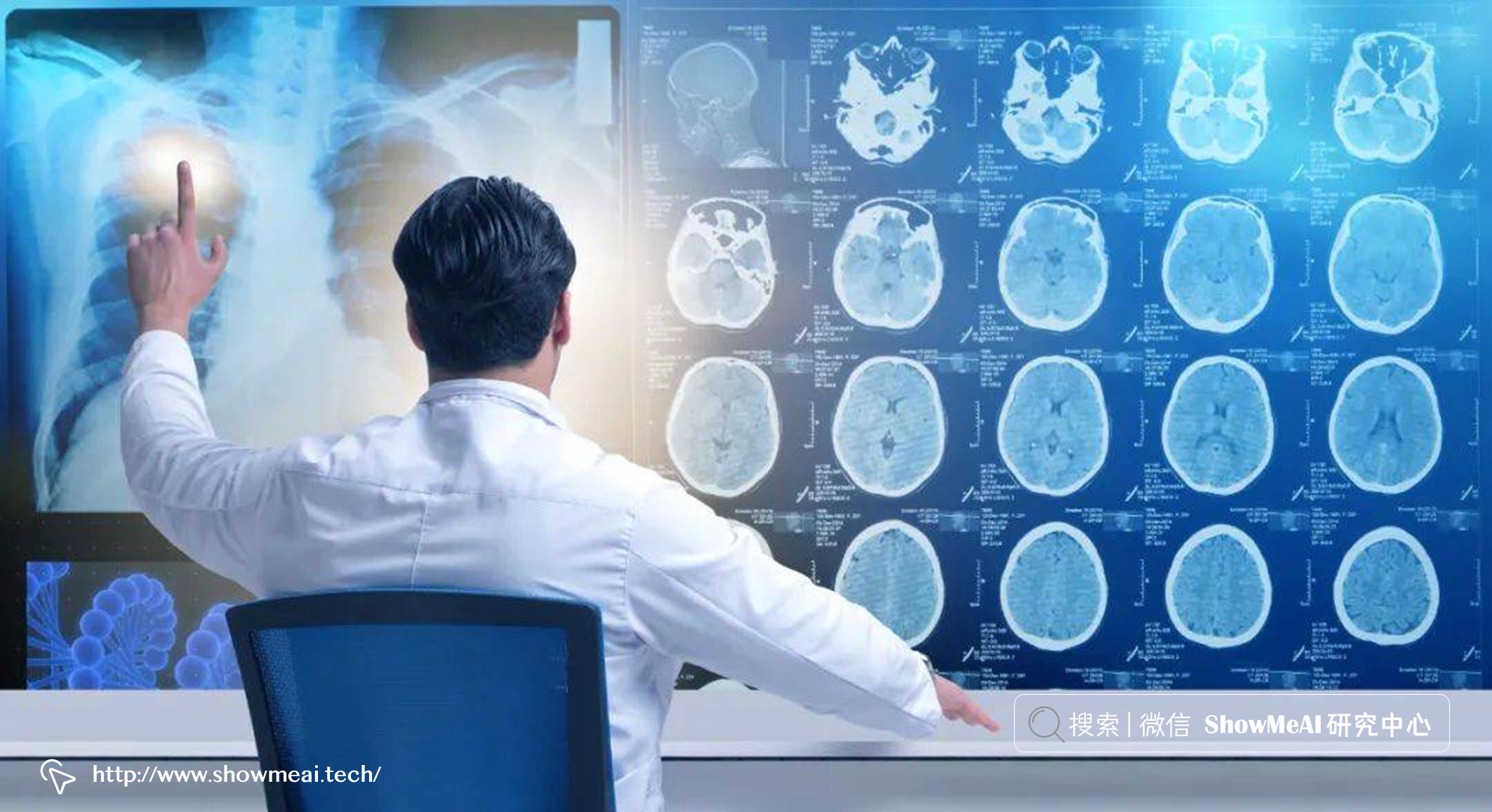AI+医疗：使用神经网络进行医学影像识别分析 ⛵