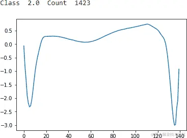 ECG 5000 第二类 2.0