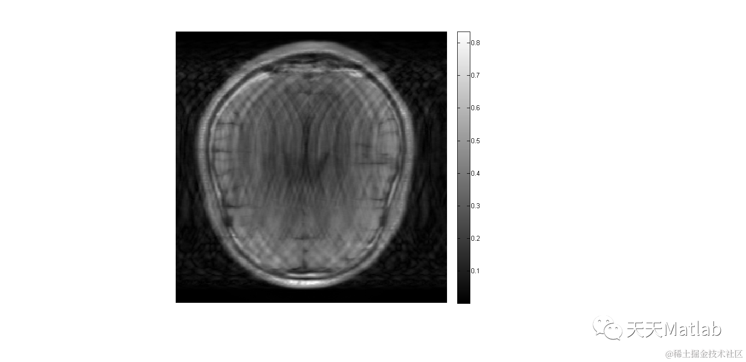 图像融合】基于平移不变剪切波小波变换实现CT图像融合matlab代码figure,imshow(abs(im1)); - 掘金