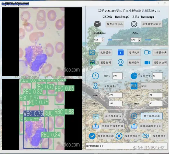 高精度红细胞白细胞血小板检测识别系统2604.png