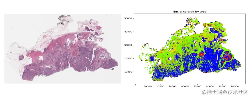 Two images showing how MONAI’s HoVerNet model is able to segment and classify a histology image.