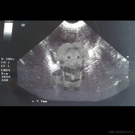 APIGuy于2023-06-26 16:30发布的图片