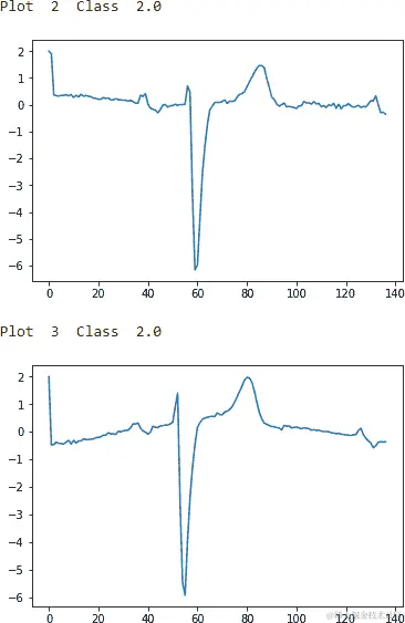 ECG Five Days Class 2.0 - First Two Examples