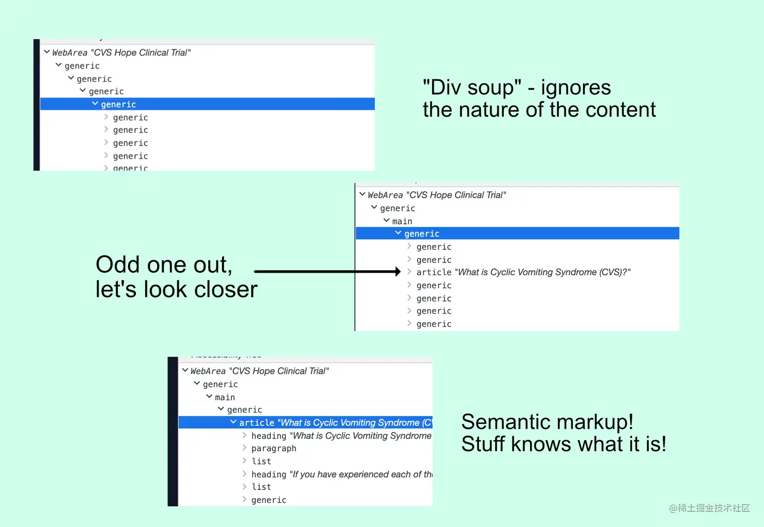 Three screenshots of an accessibility tree. One is made up only of generic containers, the text beside it reads. “Div soup - ignores the nature of the content.” The next is all generic but has a main parent element and one article element with a title, “What is Cyclic Vomiting Syndrome (CVS)?” The text beside it says the article is the odd one out and that we will look closer. The final image is the article element expanded in the accessibility tree, showing that it contains headings, paragraphs, and other semantically appropriate HTML elements. The text beside that one reads “Semantic markup! Stuff knows what it is!”