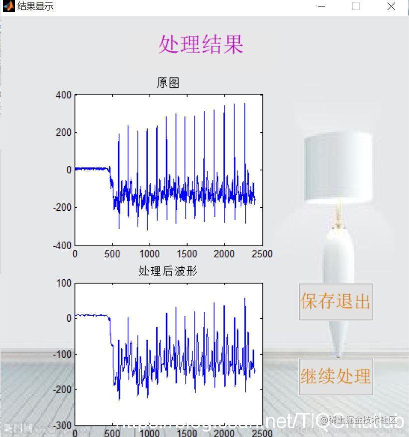 Ecg signal preprocessing based on MATLAB GUI - Moment For Technology