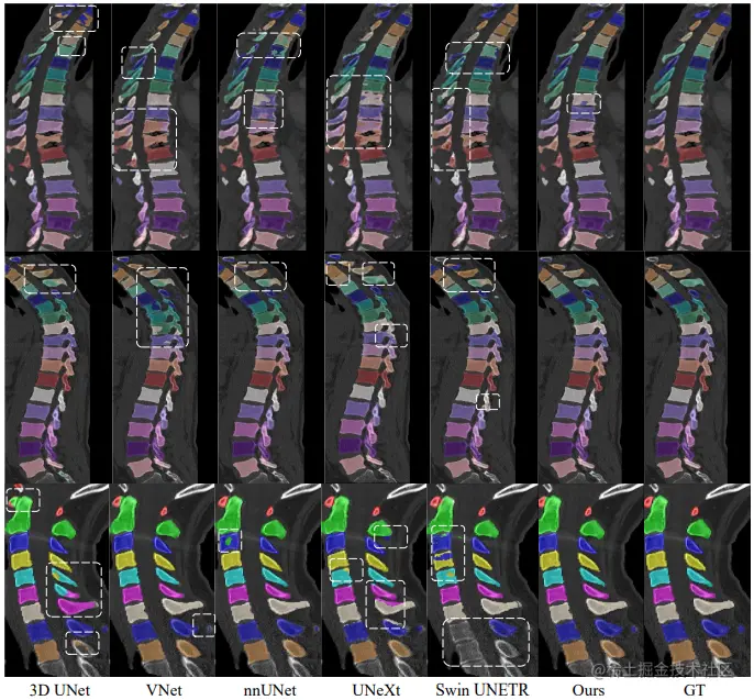 图 5：VerSe 2019 上不同模型的预测分割掩码
