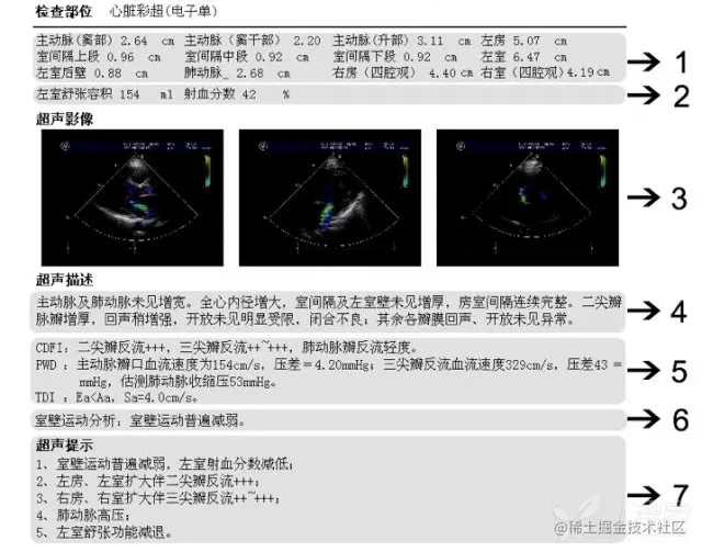 超声心动图，来源丁香园网站