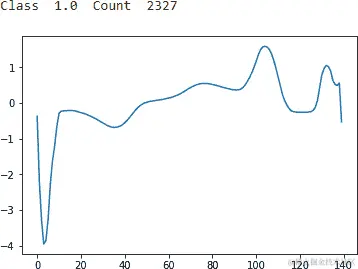 ECG 5000 第一类 1.0
