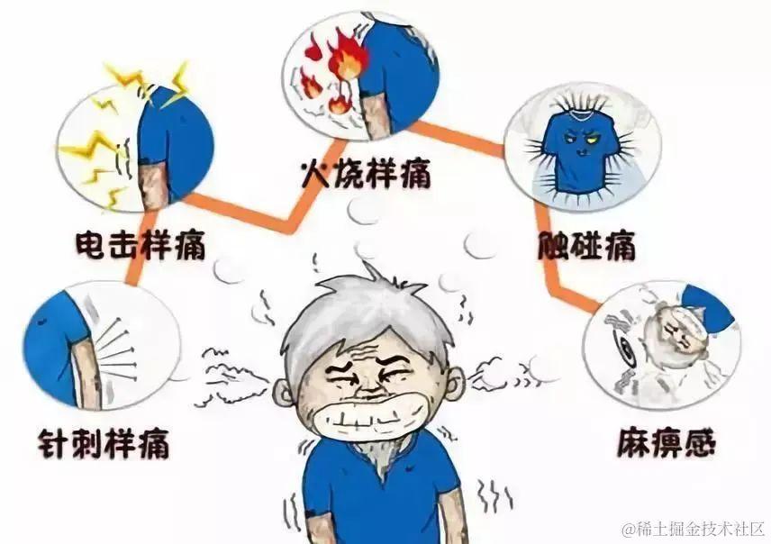 名医高效良方——三叉神经痛