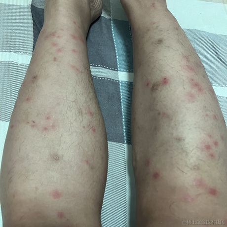 坚果派_坚果于2022-06-23 07:06发布的图片