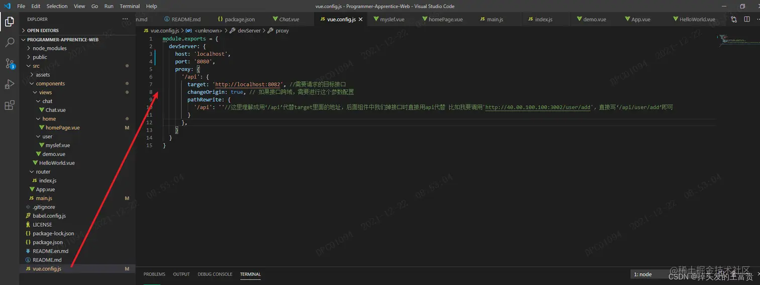 在这里插入图片描述