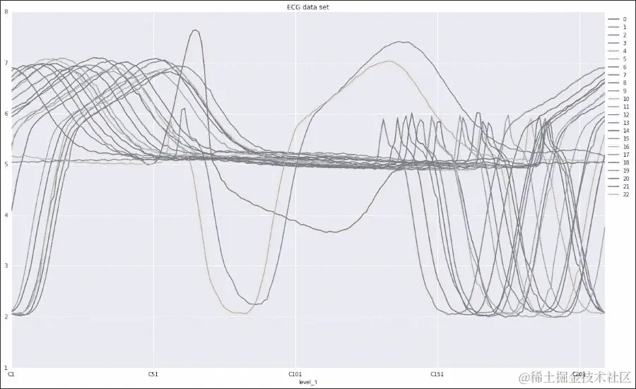 心电图脉冲检测